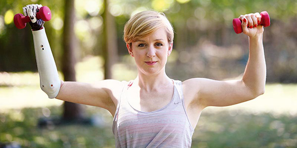 Young woman with prosthetic arm