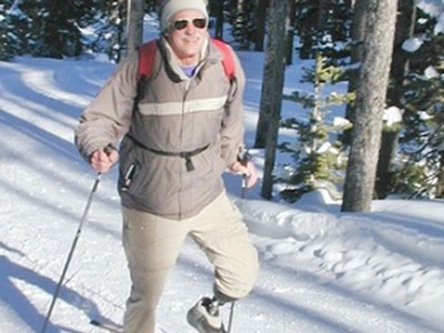 Man with prosthetic leg running on ski