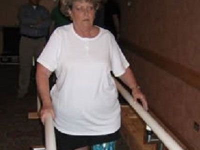 Lady rehabilitating with a prosthetic leg