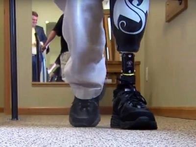Man with prosthetic leg walks for the first time