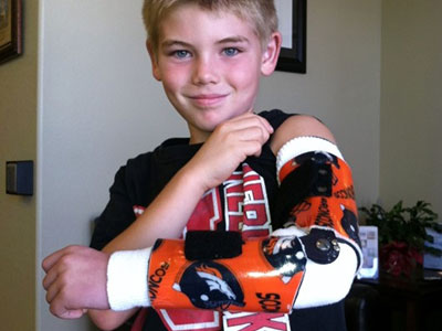 Young boy Will wearing orthosis